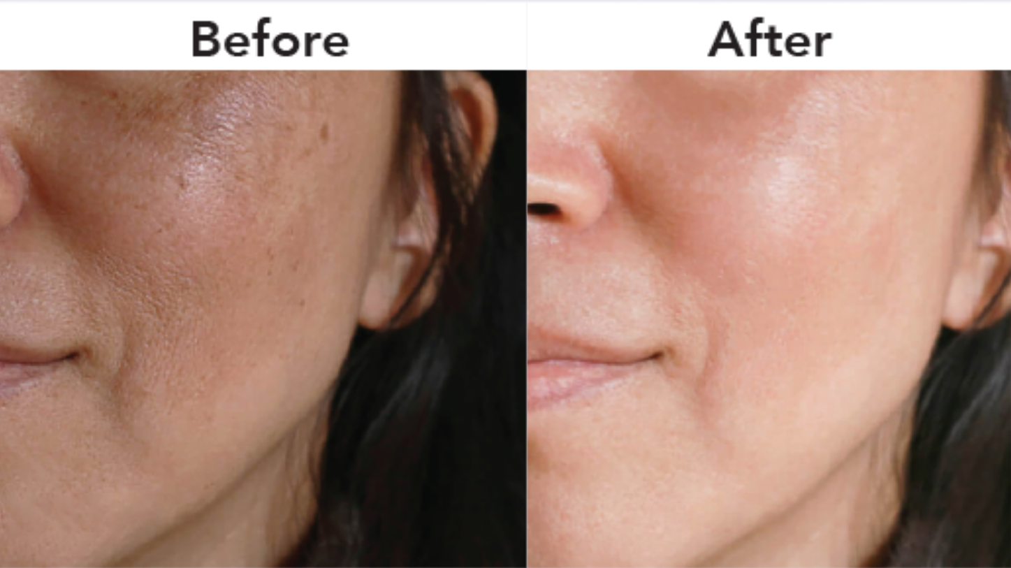 Before & After